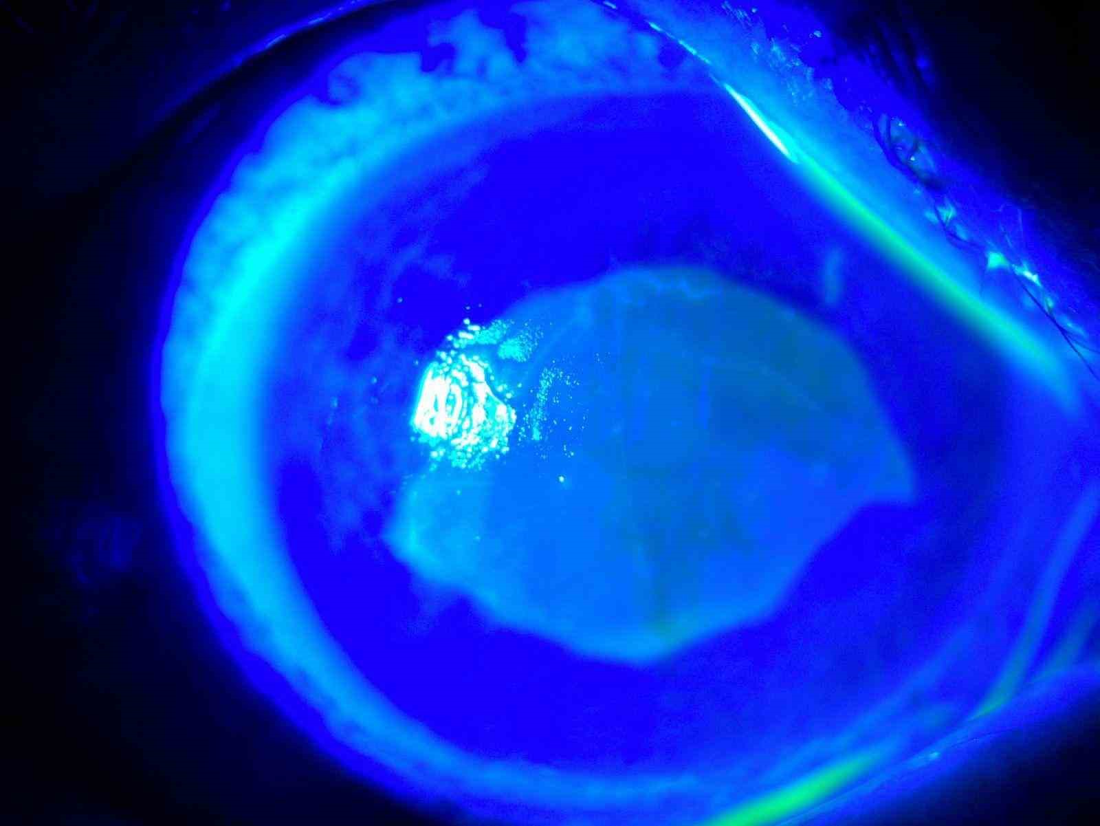 ’Kırlangıç otu kullanımı’na dikkat, uzmanlar uyarıyor: "Gözlerine suyunu damlattı, göremez hale geldi"
