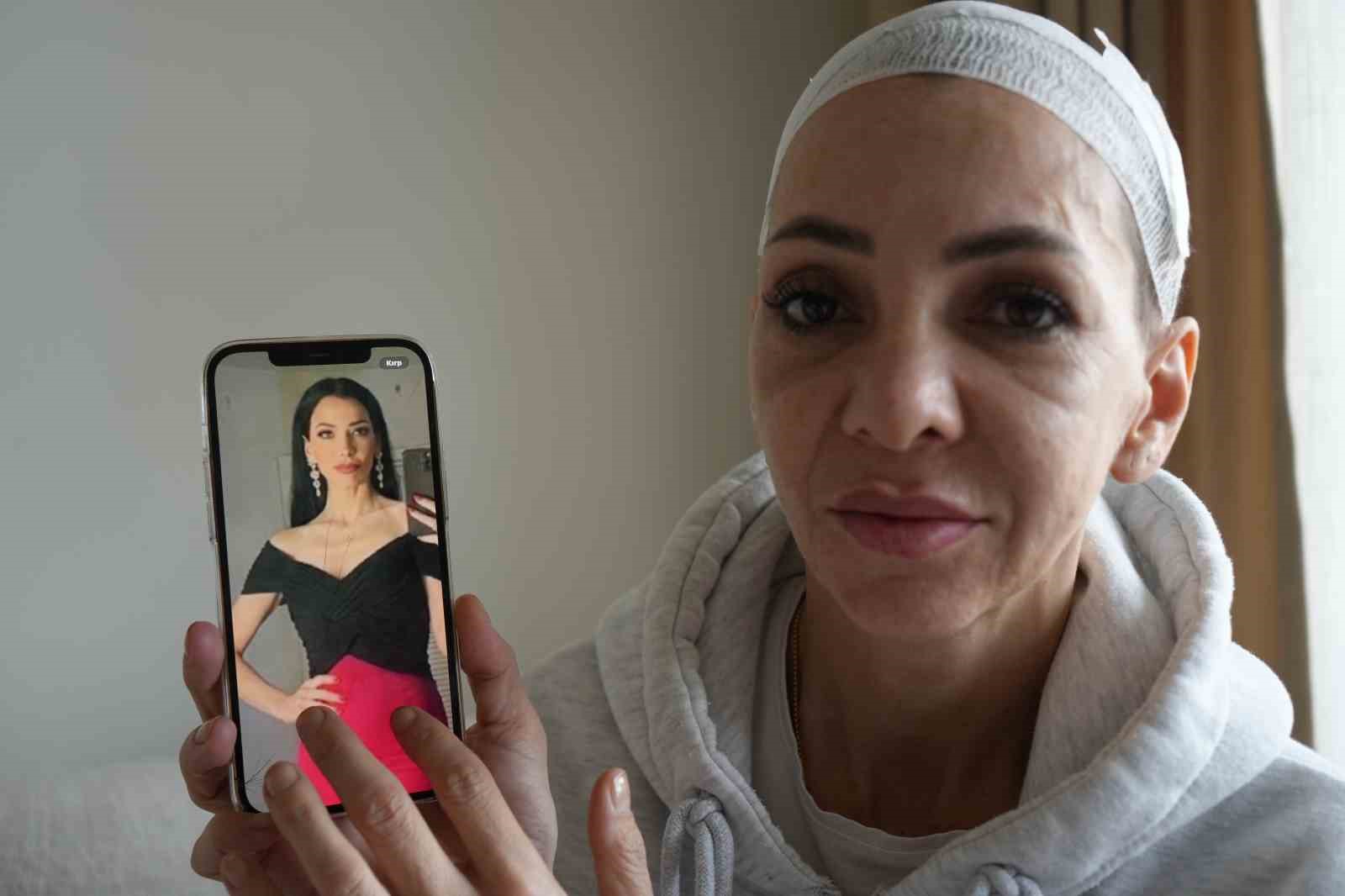 Feci şekilde darp edilmişti, yaşadığı dehşeti unutamıyor
