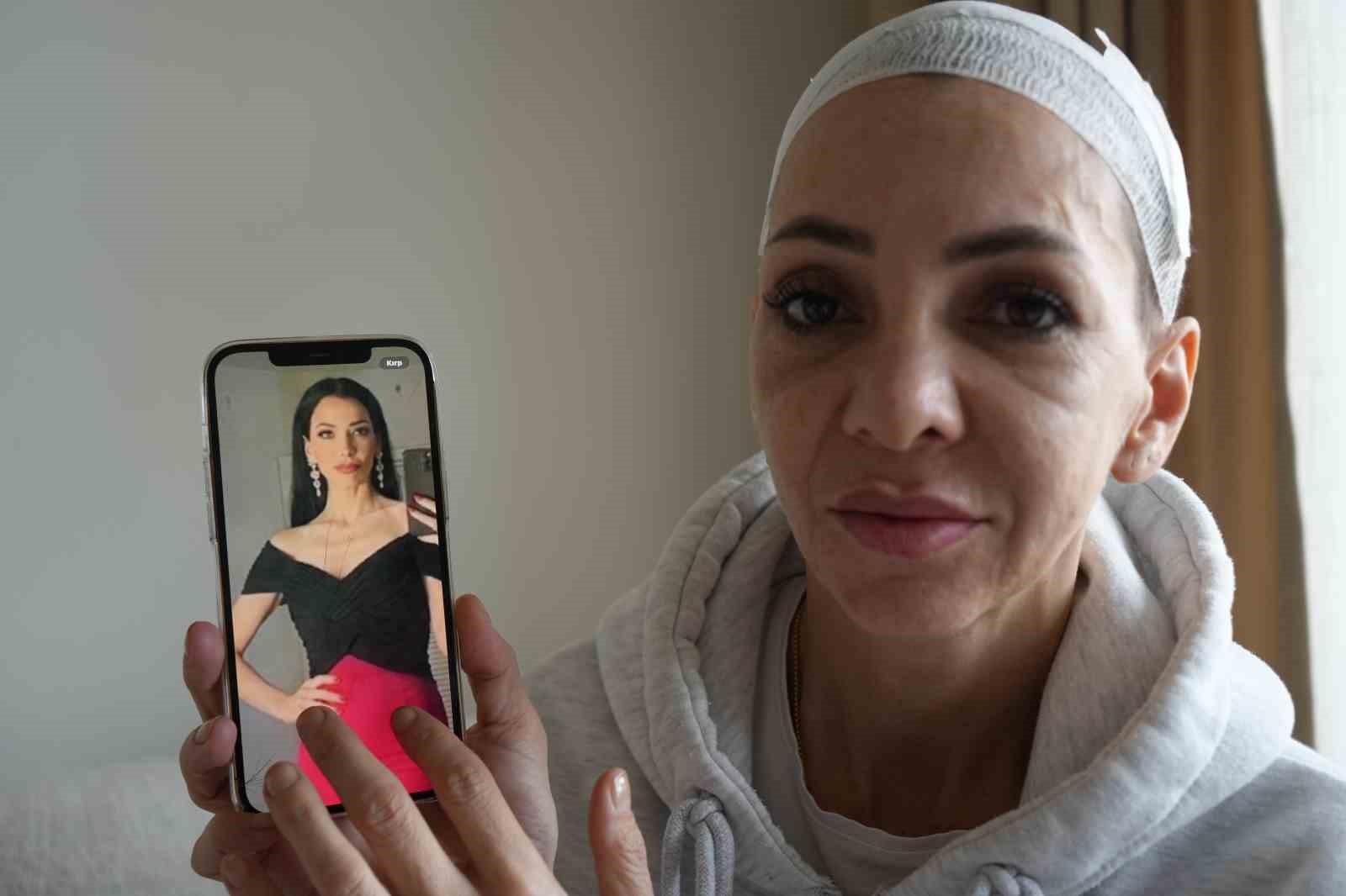 Anne ve oğlunu darp eden şüpheliler: "Merdivenlerden düştü"